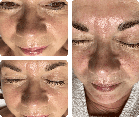 Kosmetische Gesichtsbehandlung